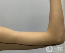 抽脂瘦手臂的風(fēng)險有什么？