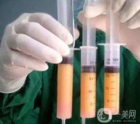 抽脂有危險嗎？有哪些危害？
