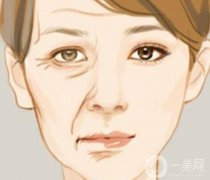 除皺的后遺癥有哪些？