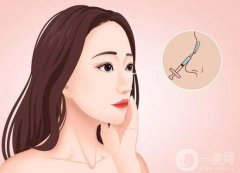 有哪些因素影響鼻翼內(nèi)切的價格？