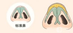 鼻頭縮小有沒有果?什么時候能看到果?