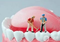 洗牙后什么時候可以吃東西？