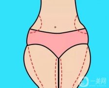 抽脂可以瘦多少？抽脂手術(shù)方法有哪些？