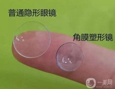 角膜塑形鏡有什么作用？