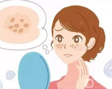 有哪些正確的祛斑方法？