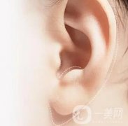 有哪些豐耳垂的方法？