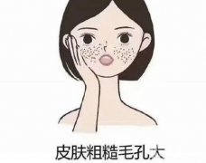 毛孔粗大是什么原因?激光可以改良嗎？