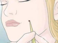 激光點(diǎn)痣后的小洞洞如何護(hù)理？