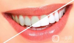 導(dǎo)致牙齒變黃的原因是什么