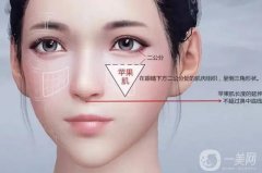 豐蘋(píng)果肌失敗怎么辦?