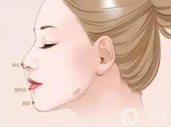 玻尿酸墊下巴怎么護(hù)理能夠？