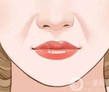 墊鼻基底能有改良法令紋嗎？