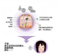 復(fù)合彩光嫩膚是什么？風(fēng)險(xiǎn)有哪些？