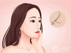 硅膠隆鼻好嗎？可以取出硅膠隆鼻嗎？