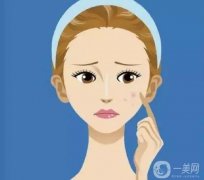 光子嫩膚可以去除雀斑、黃褐斑嗎？
