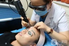 激光洗眉后紅色印記多久會(huì)消失？怎么護(hù)理？