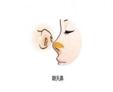 矯正朝天鼻存在風(fēng)險(xiǎn)嗎？矯正失敗時(shí)會(huì)怎么樣？
