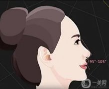 隆鼻后發(fā)生碰撞了怎么辦？還能恢復(fù)嗎？