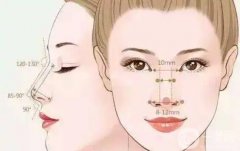 墊鼻梁的果會(huì)永遠(yuǎn)維持嗎？