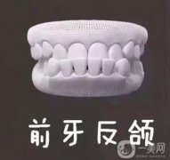 地包天能做手術(shù)糾正嗎？