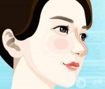 膨體隆鼻嗎？有沒有后遺癥？