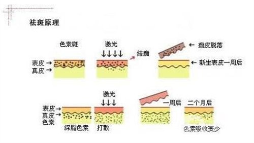 天津醫(yī)科大學(xué)腫瘤醫(yī)院整形科價(jià)格表，附激光祛斑恢復(fù)*果圖