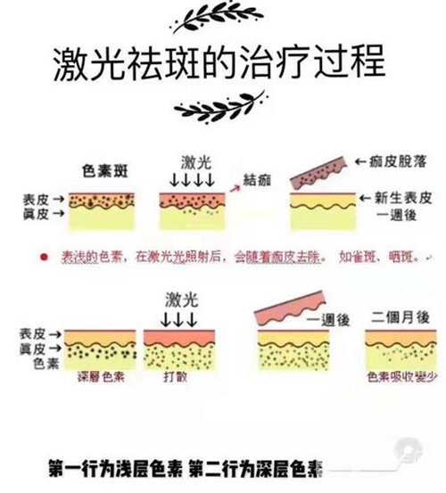 天津醫(yī)科大學(xué)腫瘤醫(yī)院整形科價(jià)格表，附激光祛斑恢復(fù)*果圖