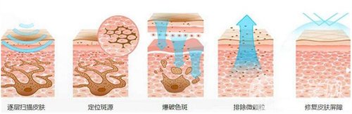 天津醫(yī)科大學(xué)腫瘤醫(yī)院整形科價(jià)格表，附激光祛斑恢復(fù)*果圖