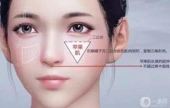 蘋(píng)果肌填充有什么后遺癥？