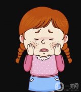 激光祛斑后有哪些需要注意?激光去斑果怎么樣？