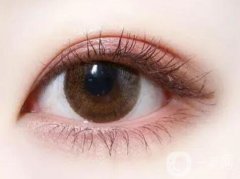 雙眼皮有哪些類型？割雙眼皮有哪些術(shù)前準(zhǔn)備？