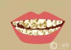 氟斑牙形成的原因有哪些，如何調(diào)節(jié)氟斑牙？