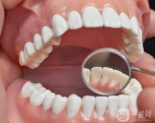 冷光美白牙齒的步驟？哪些人群不適合冷光美白？