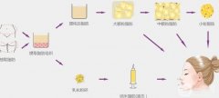 自體脂肪填充將來會消失嗎？