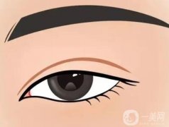 埋線雙眼皮和全切雙眼皮信息介紹？