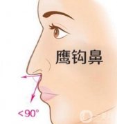 墊鼻尖用什么材料好？