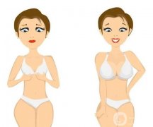 隆胸會(huì)被別人看出來(lái)嗎？科普了解！