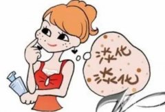 為什么激光能祛斑？激光祛斑會不會留下疤痕？