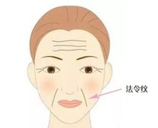 通常用哪些方法可以消除法令紋？