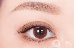 誰(shuí)適合割雙眼皮，割雙眼皮后需要多長(zhǎng)時(shí)間消腫？