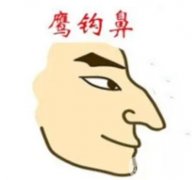 影響鷹鉤鼻矯正價格的因素有哪些？