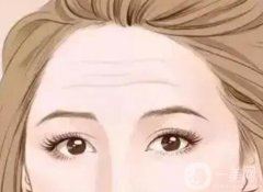 抬頭紋注射玻尿酸可以管多久？