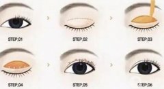 雙眼皮手術(shù)恢復(fù)需要多長時間？