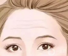 有抬頭紋的原因是什么？可以去掉嗎？