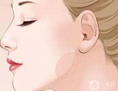 下頜角整容疼嗎？果好嗎？
