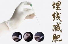 埋線減肥的風險有哪些？