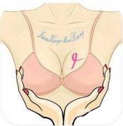隆胸有可能得乳腺癌嗎？