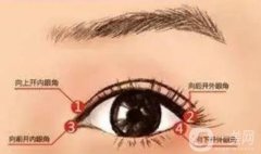 做外眼角會(huì)回縮嗎？會(huì)反彈嗎？應(yīng)該怎么護(hù)理？