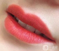 自體脂肪豐唇一般需要多少錢(qián)？