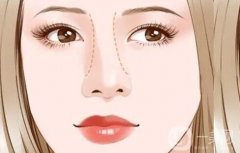 歪鼻子矯正手術有哪些禁忌癥？